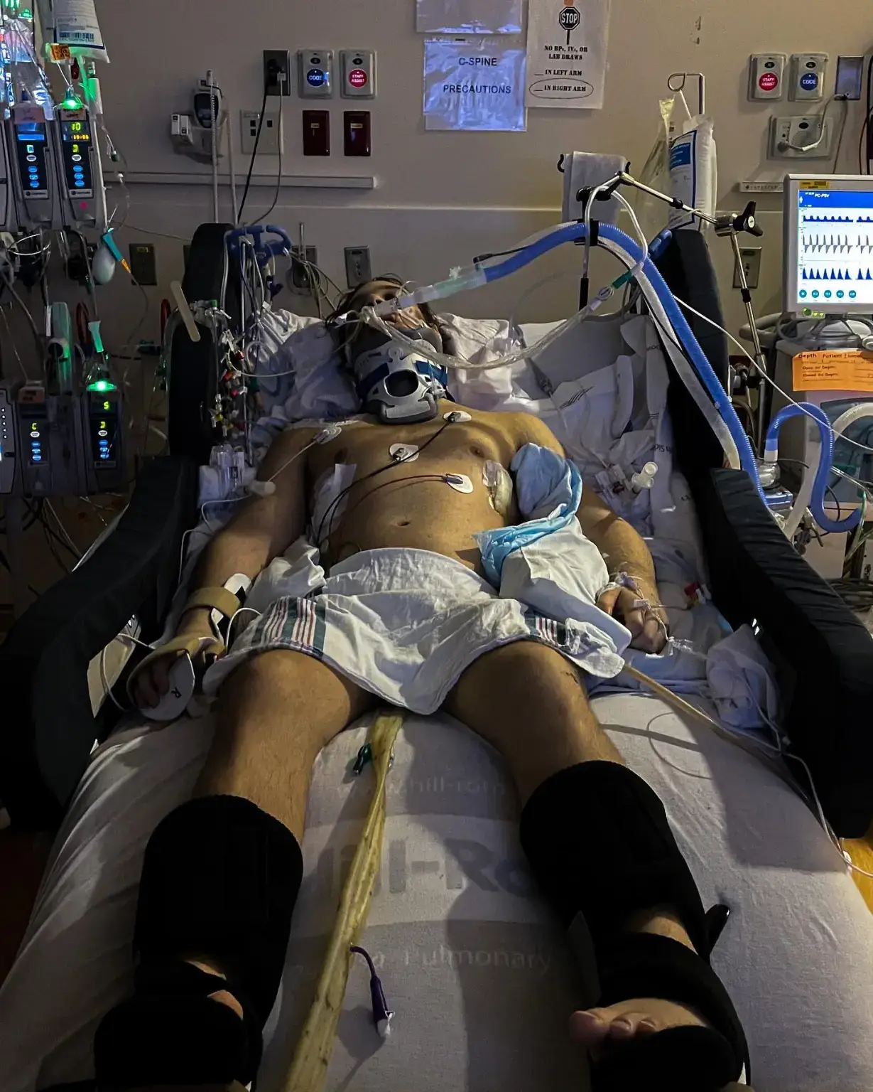 Jackson suffered a horrific accident in 2021 (Instagram/@jacksonschop)