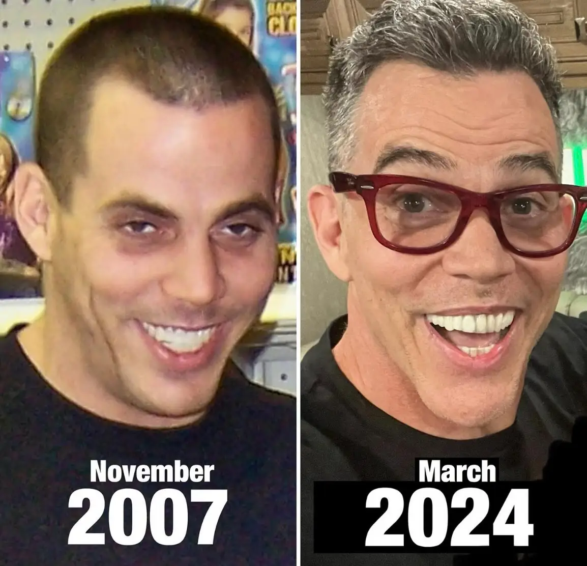 The Jackass star shared this side-by-side comparison while celebrating 16 years of sobriety in 2024 (Instagram/@steveo)