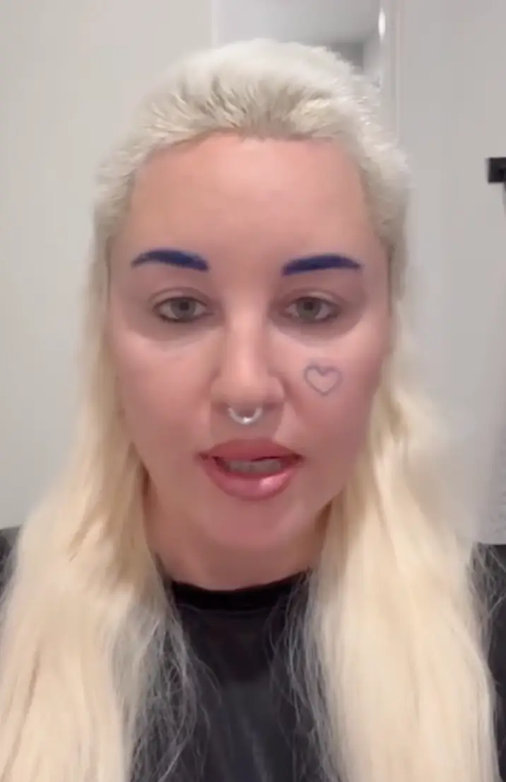 Bynes opened up about eyelid surgery.