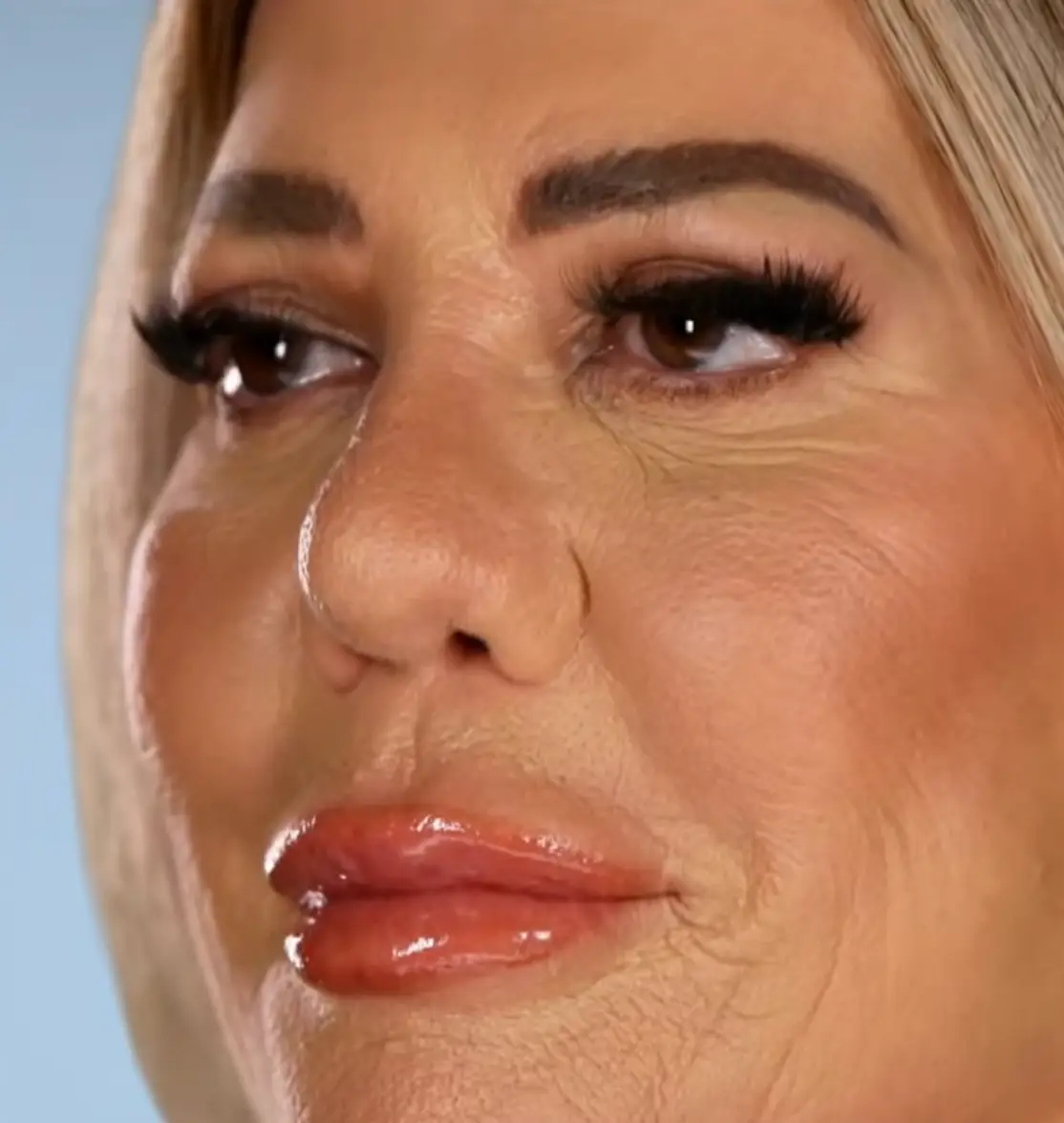 Demi after her surgery (E! Entertainment via YouTube)