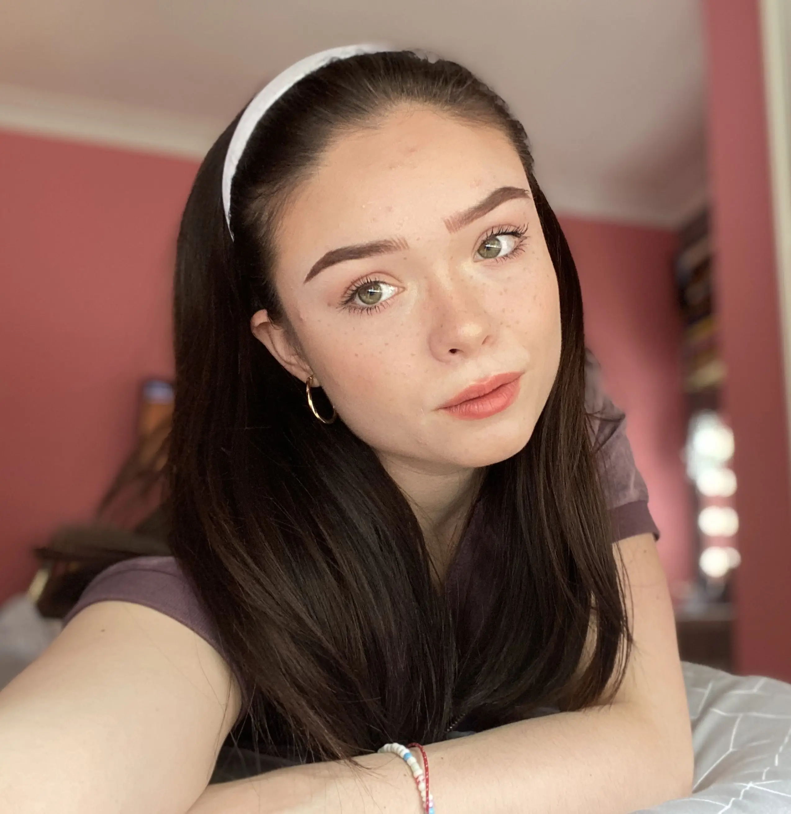 Fortunately, Savannah's burns are healing well (Kennedy News and Media)