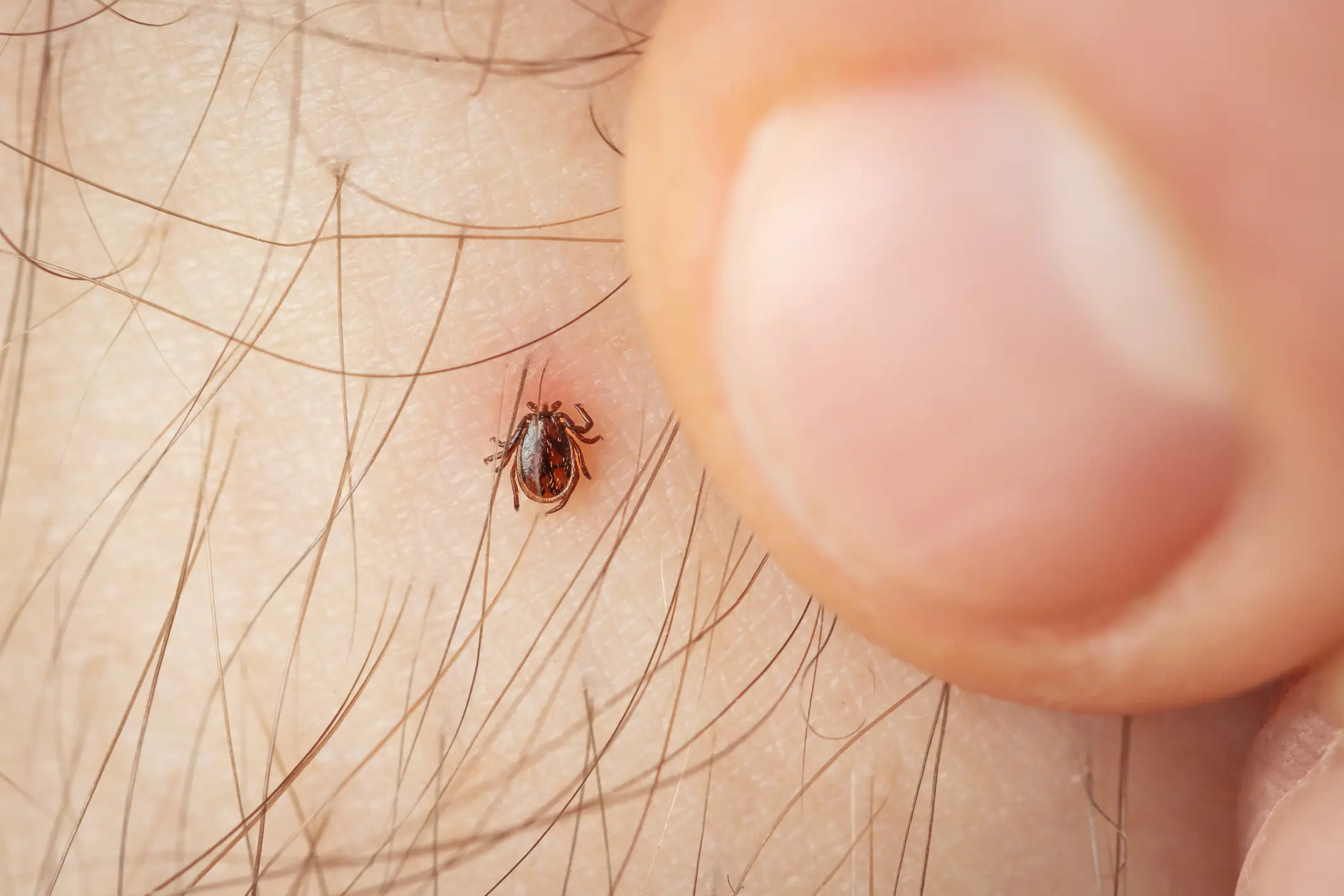 Ticks can be found in grassy and woodland areas (Getty Stock Photo)