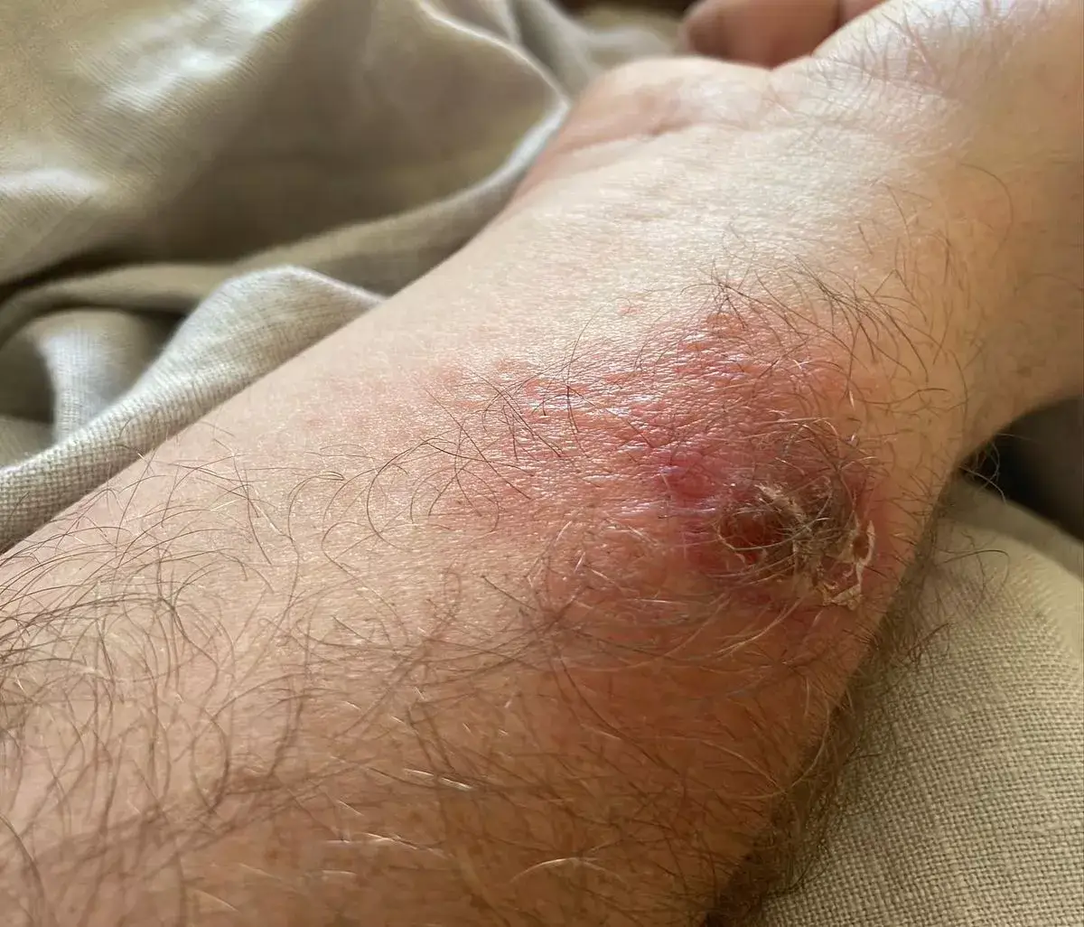 The singer updated fans after the incident.