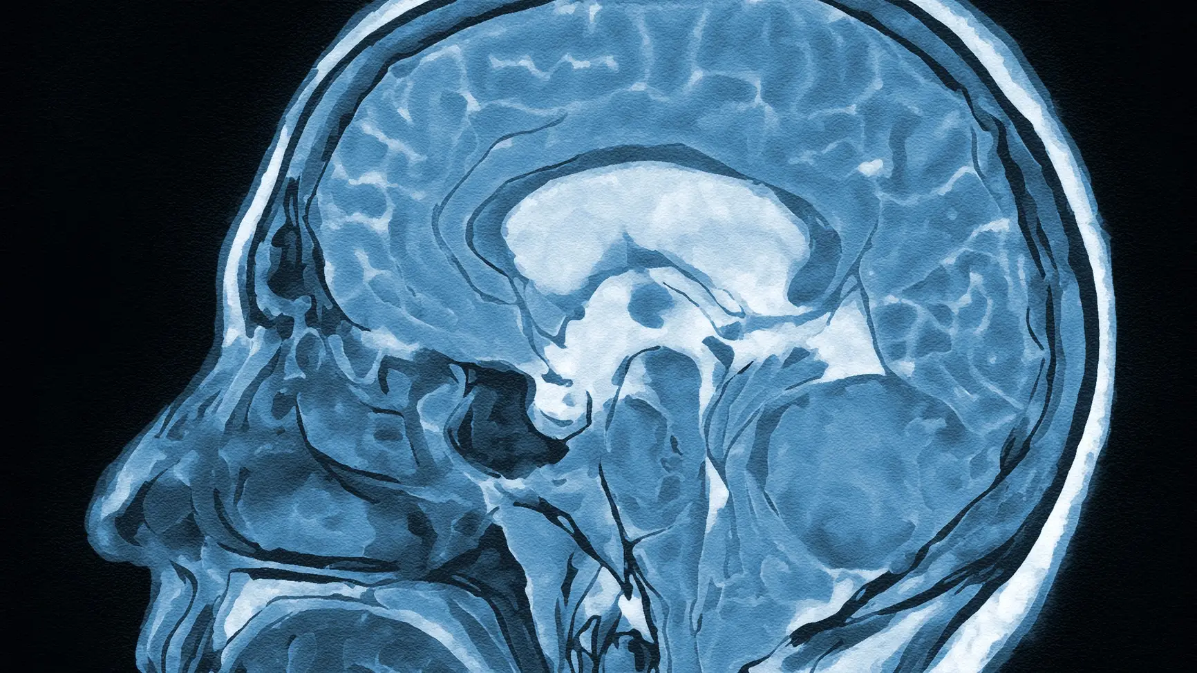 A brain scan has revealed a big difference. (Getty stock)