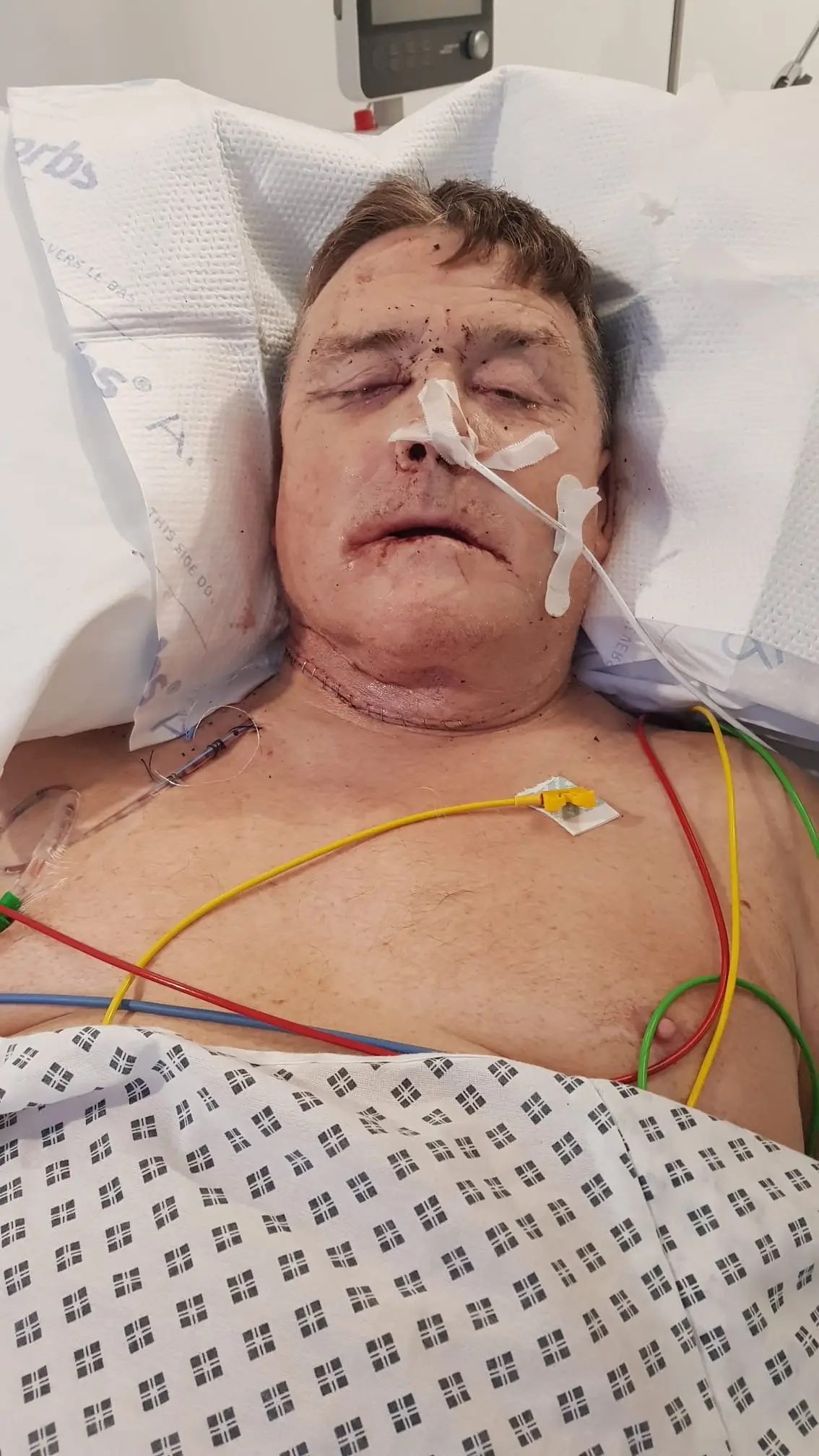 Peter was diagnosed with mouth cancer (SWNS)