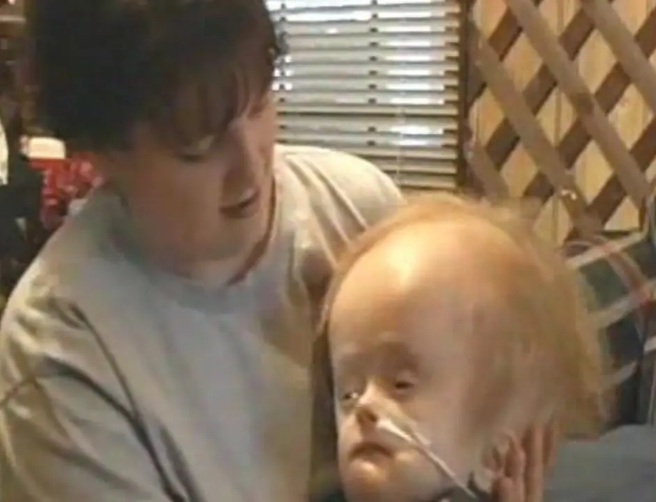 Trevor's surviving brain stem meant he could live a longer life than expected (KSLA)