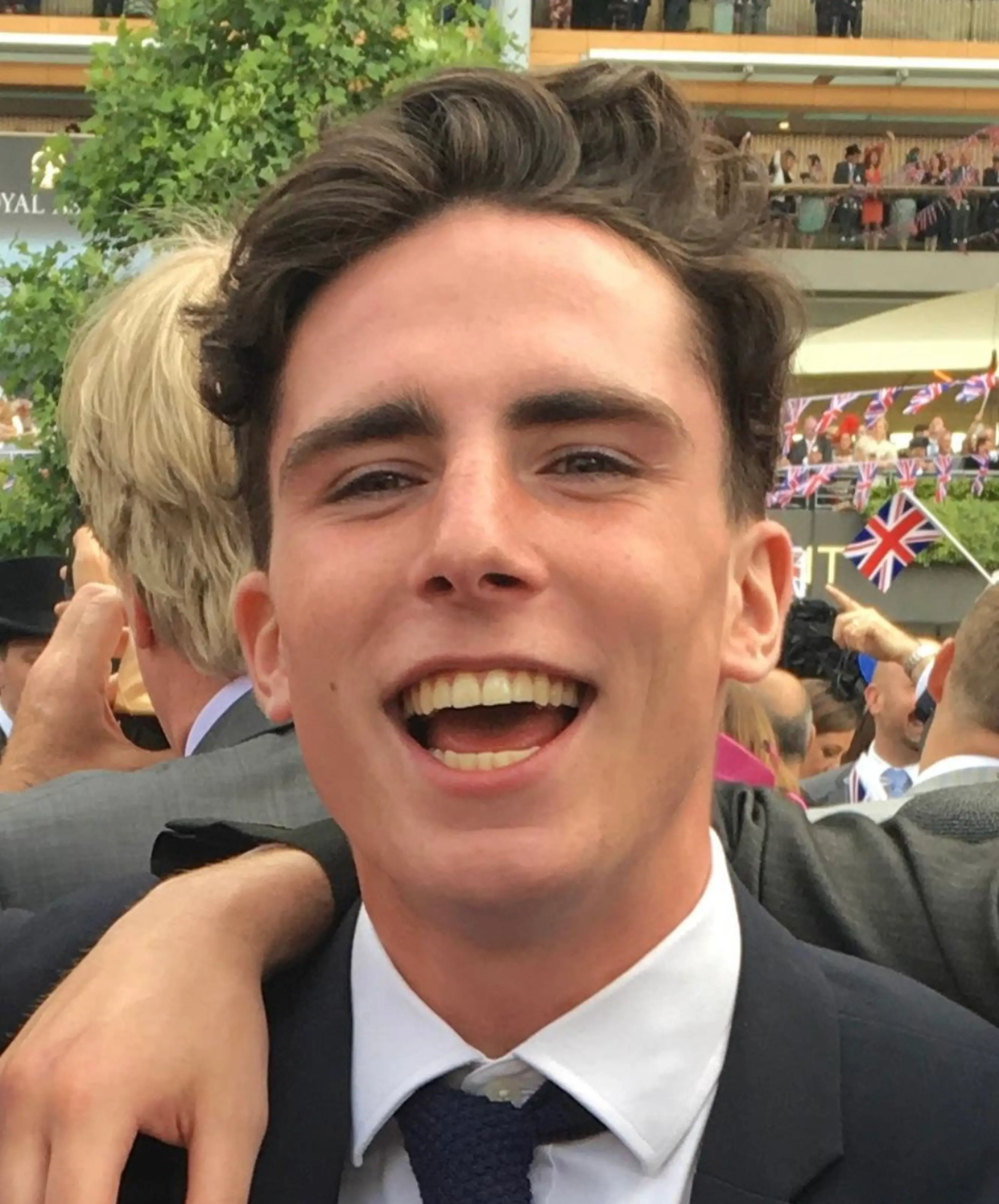 Ben Parsons was burnt to a crisp after falling asleep on the beach in the South of France (Kennedy News and Media)