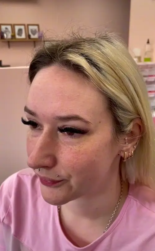 Client Michaela before the freckle tattoo