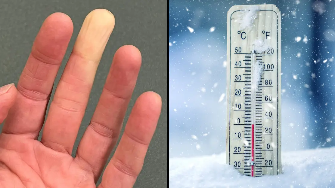 One minute quiz can let you know if you have common disease that turns fingers white in cold months