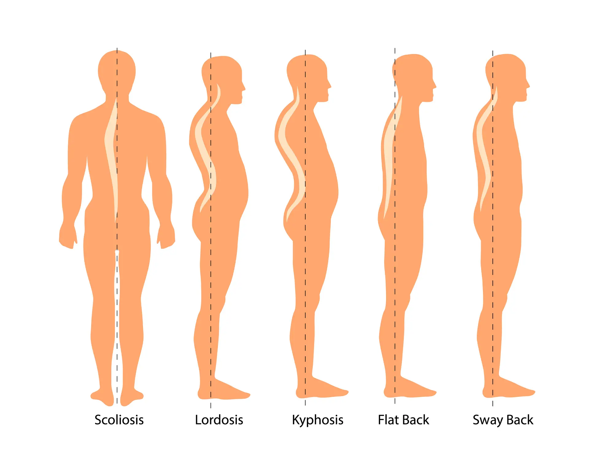Posture alone isn't enough to determine whether someone is a psychopath or not (Getty Stock Images)