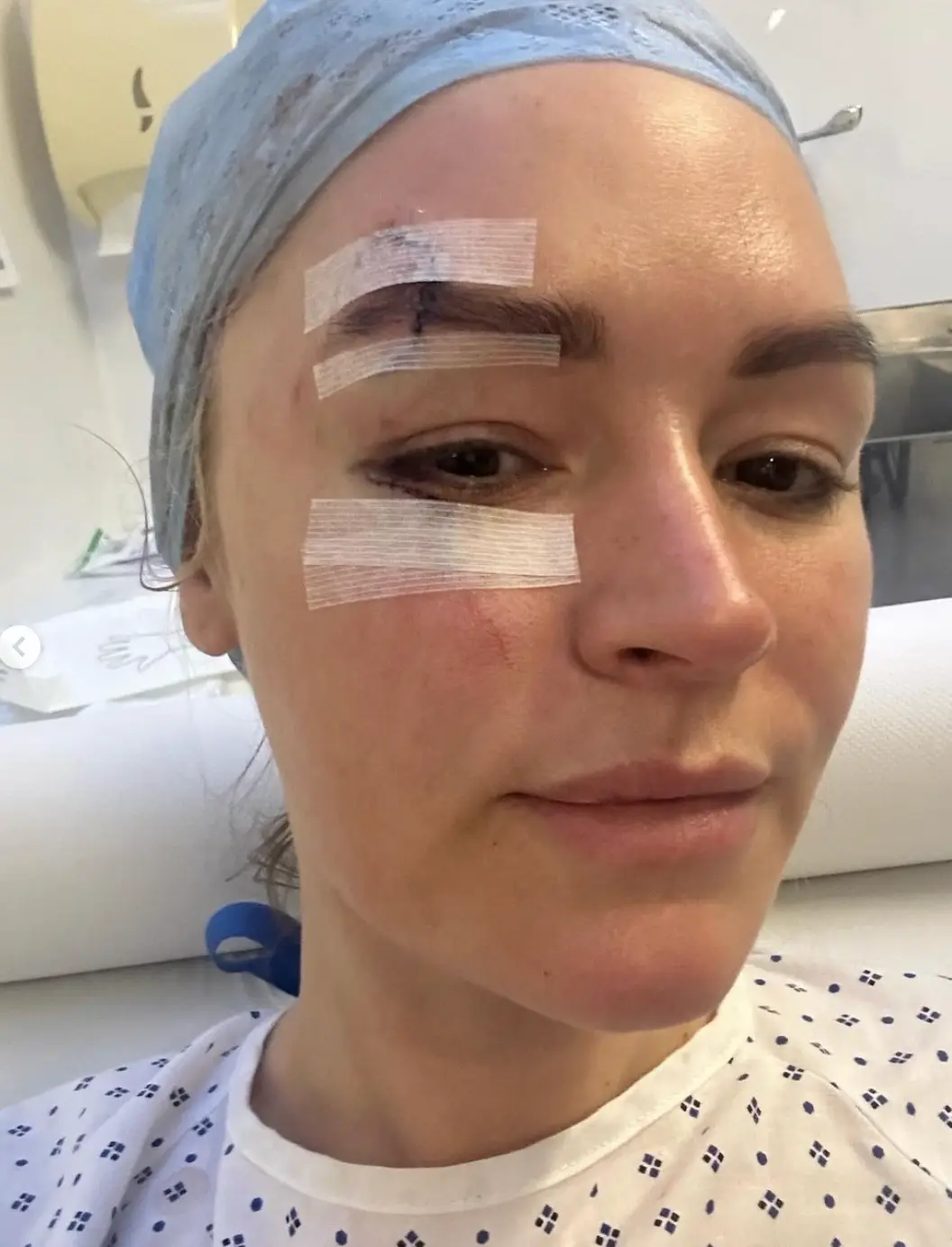 Laura Woods has had to pull out of covering tonight's fight after sustaining an injury of her own. (Instagram/@laurawoodsy)