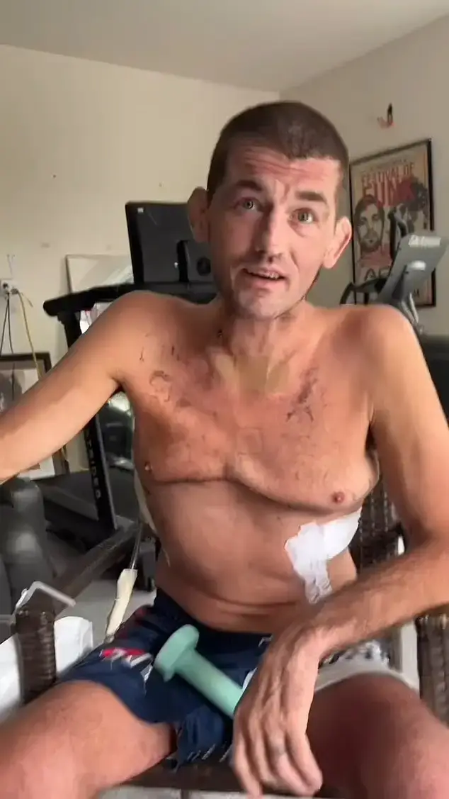 Last year Ben Askren had a double lung transplant, with him needing a lot of physical recovery afterwards (Instagram/@benaskren)