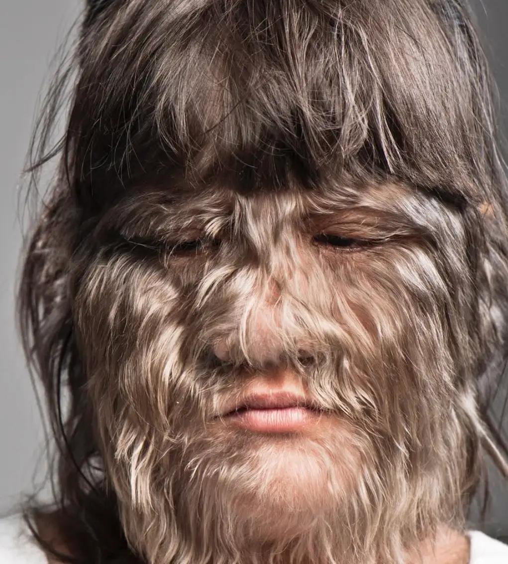 Supatra Sasuphan was crowned the world's hairiest teenager in 2010 (Instagram/Guinness World Records)
