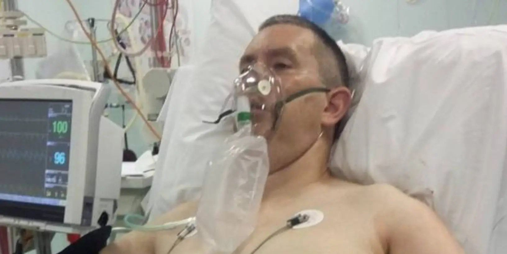 Jamie is lucky to be alive.