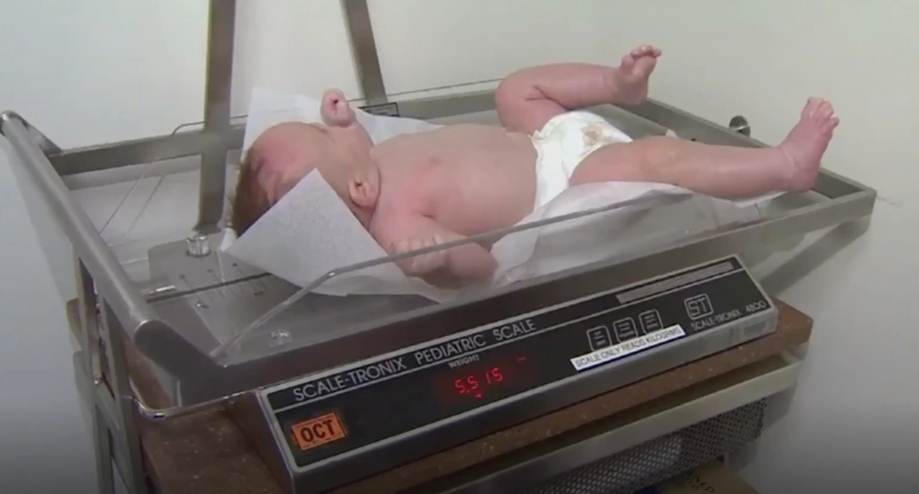 Lynlee was eventually born at the much healthier weight of 5lbs and 5oz (BBC News)