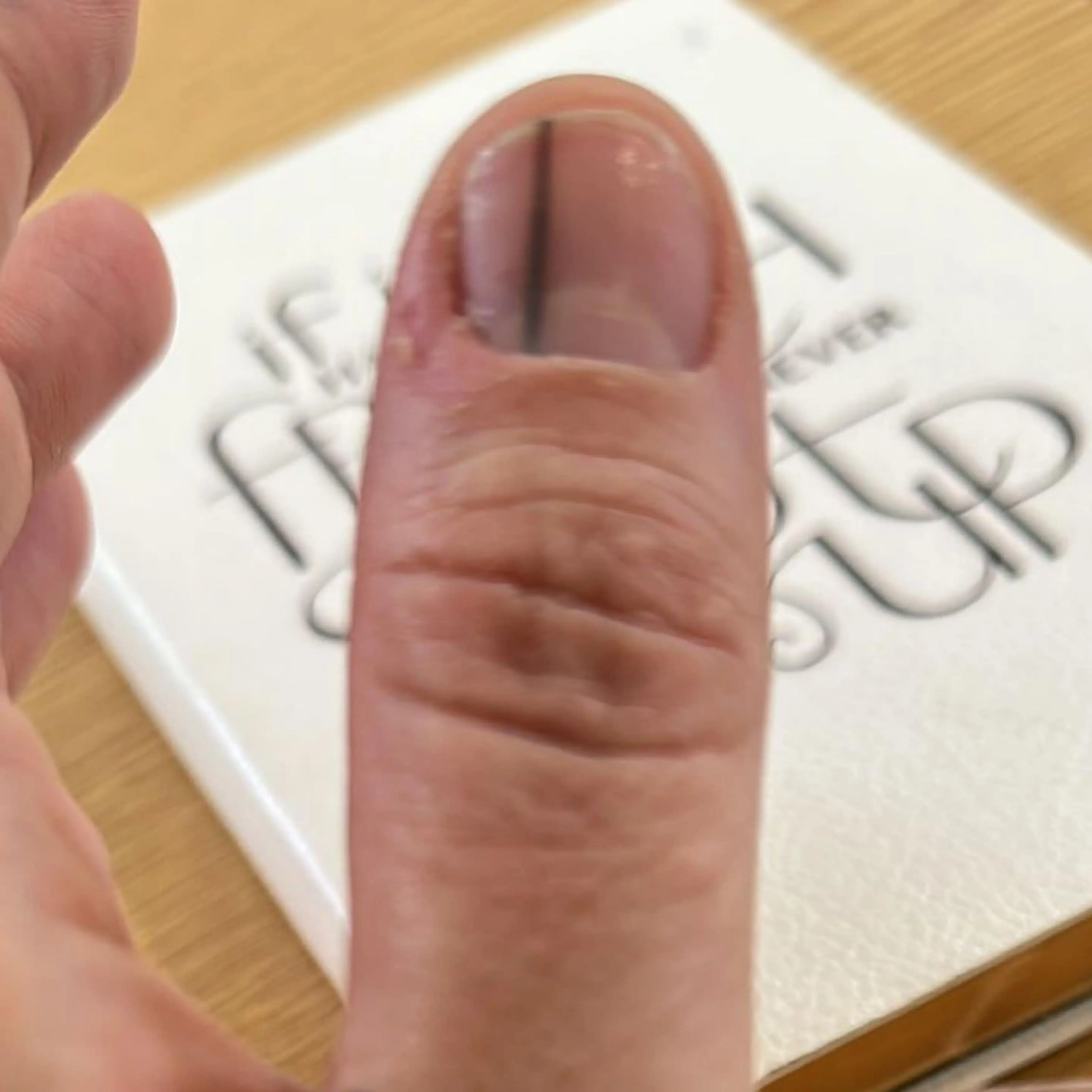 Lucy has issued a warning to anyone who has a similar mark on their nail (Kennedy News and Media)