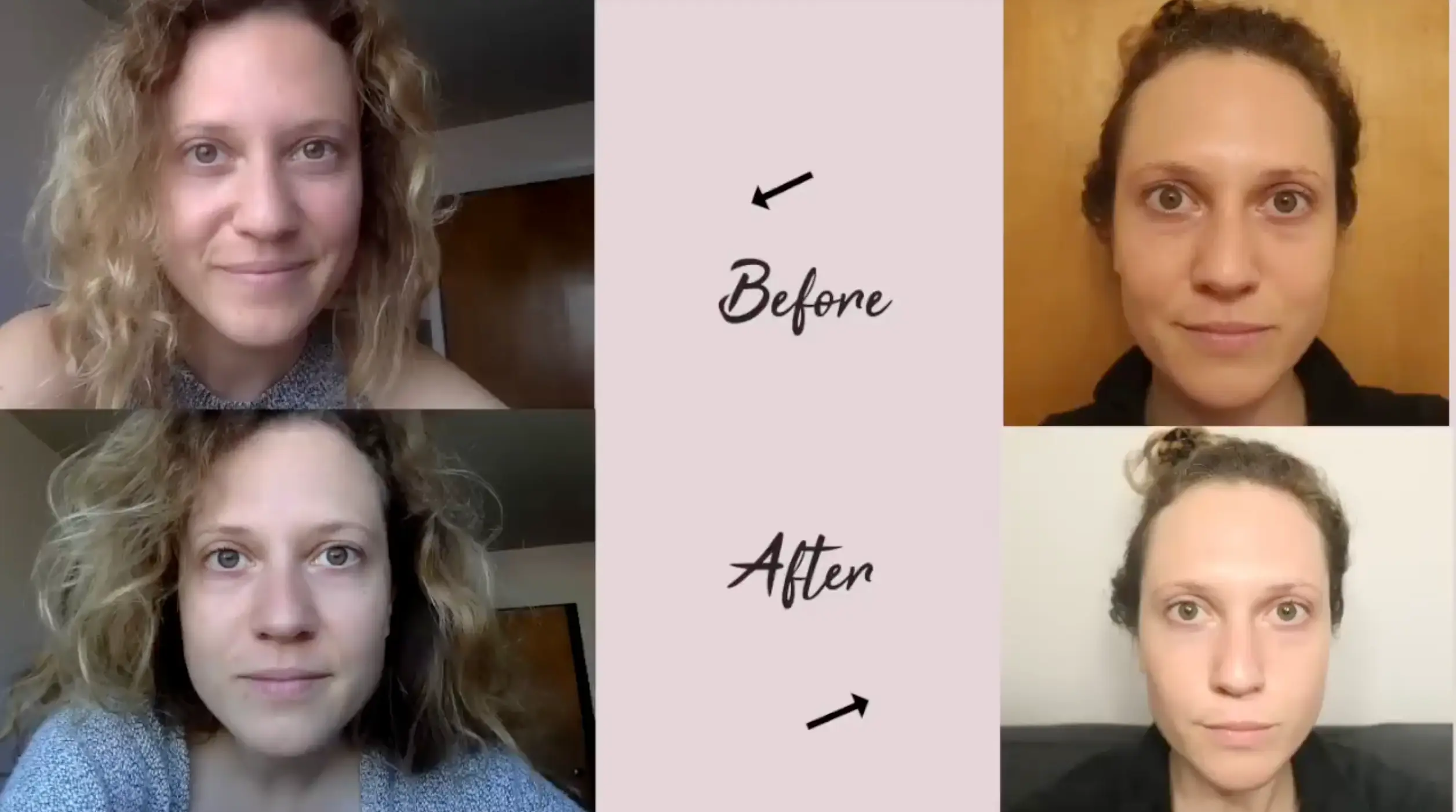 The YouTuber said that she noticed changes in the texture of her skin (YouTube/Sara Anderson)