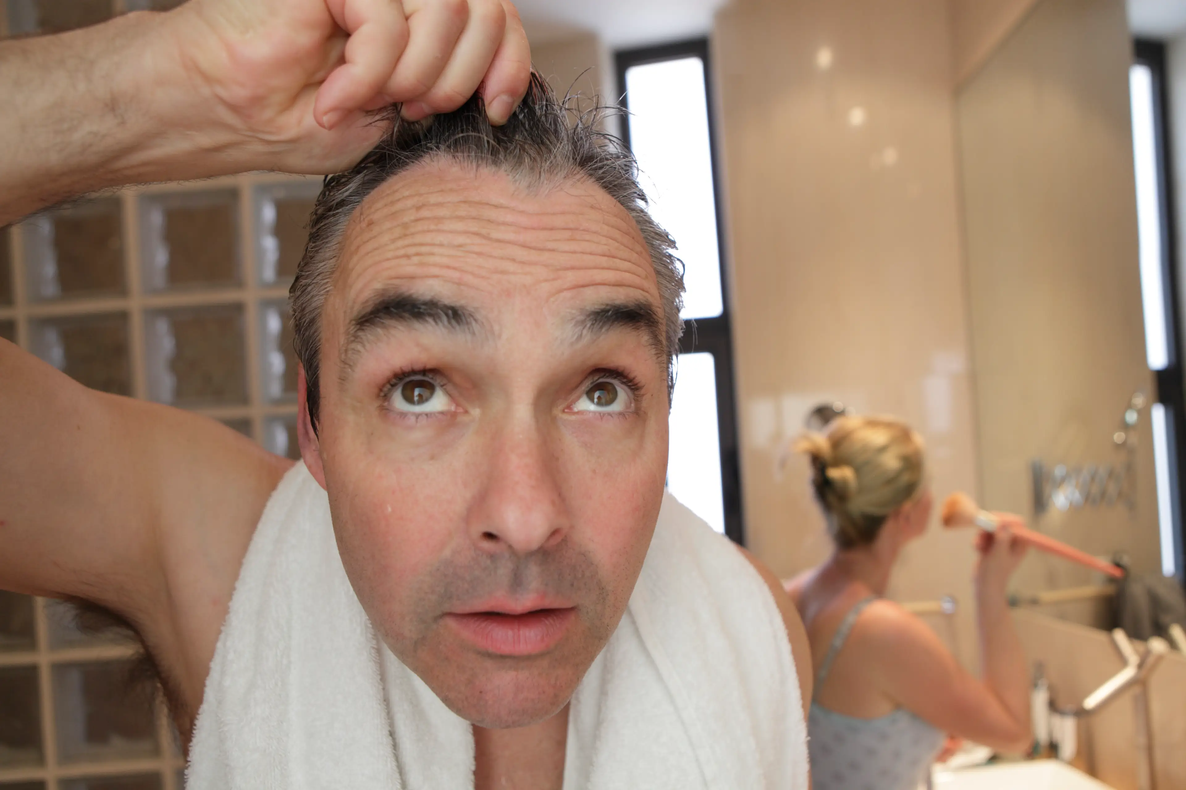 It's not quite what it was, though perhaps the balding process could be stopped. (Getty Stock Image)