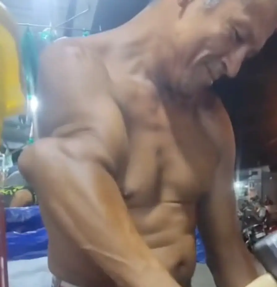 The man has what appears to be a nonunion fracture.