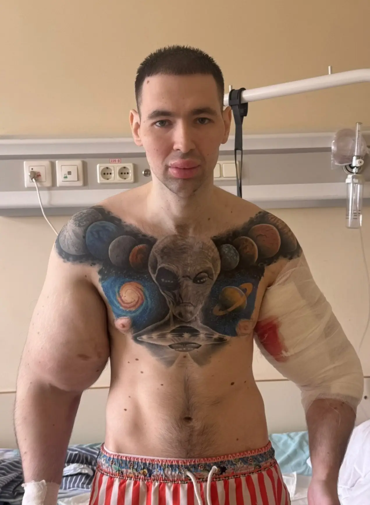 He finally had surgery last week (Instagram/ruki_bazuki_official)