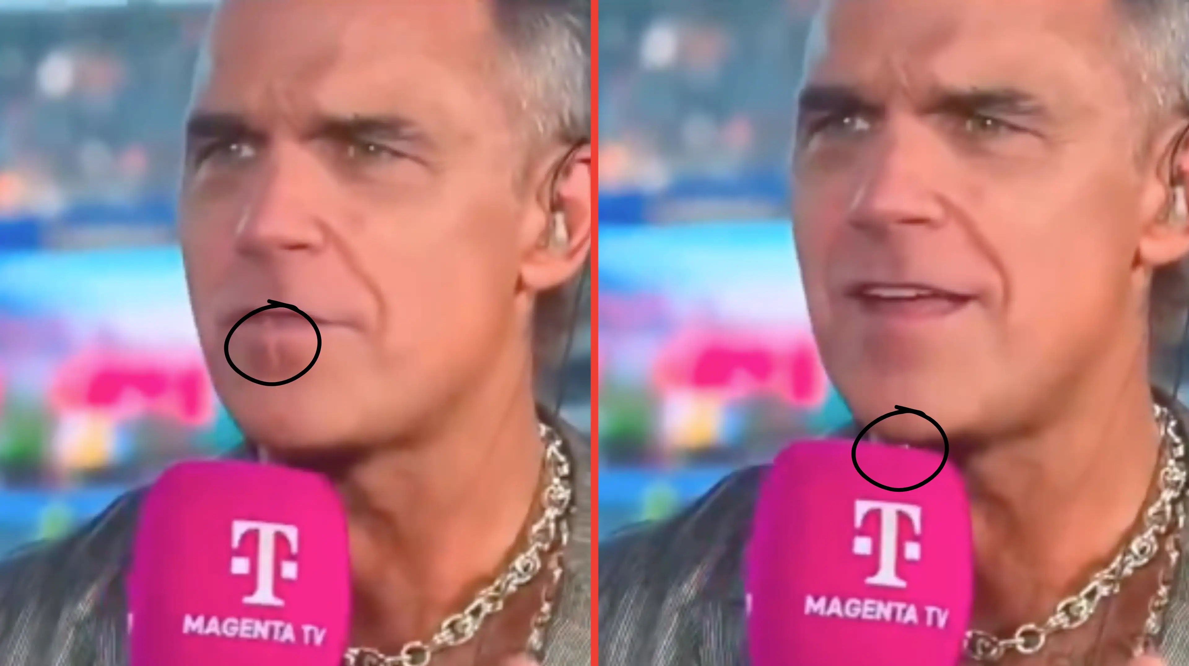 The moment something seemed to fall out of Robbie Williams' mouth (Magenta TV )