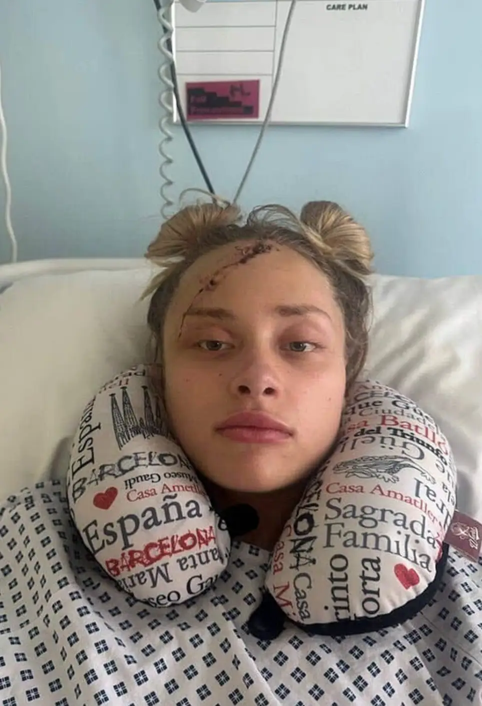 Maria suffered extensive injuries, including a fracture in her spine, broken legs, a broken wrist and head trauma (Instagram/mariia.kovalchuuk)
