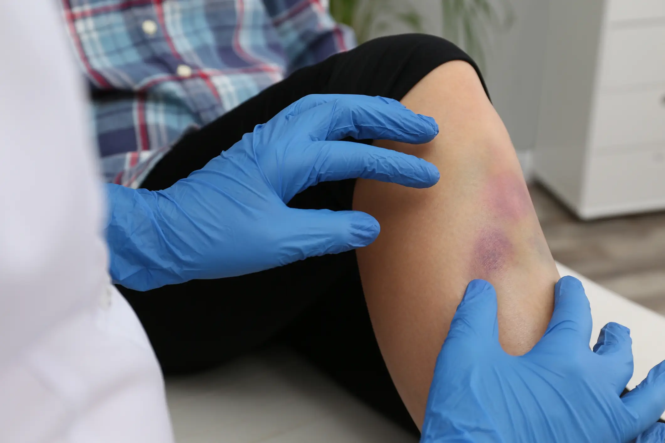 You should see a medical professional if your bruise does any of these things. (Getty Stock Photo)