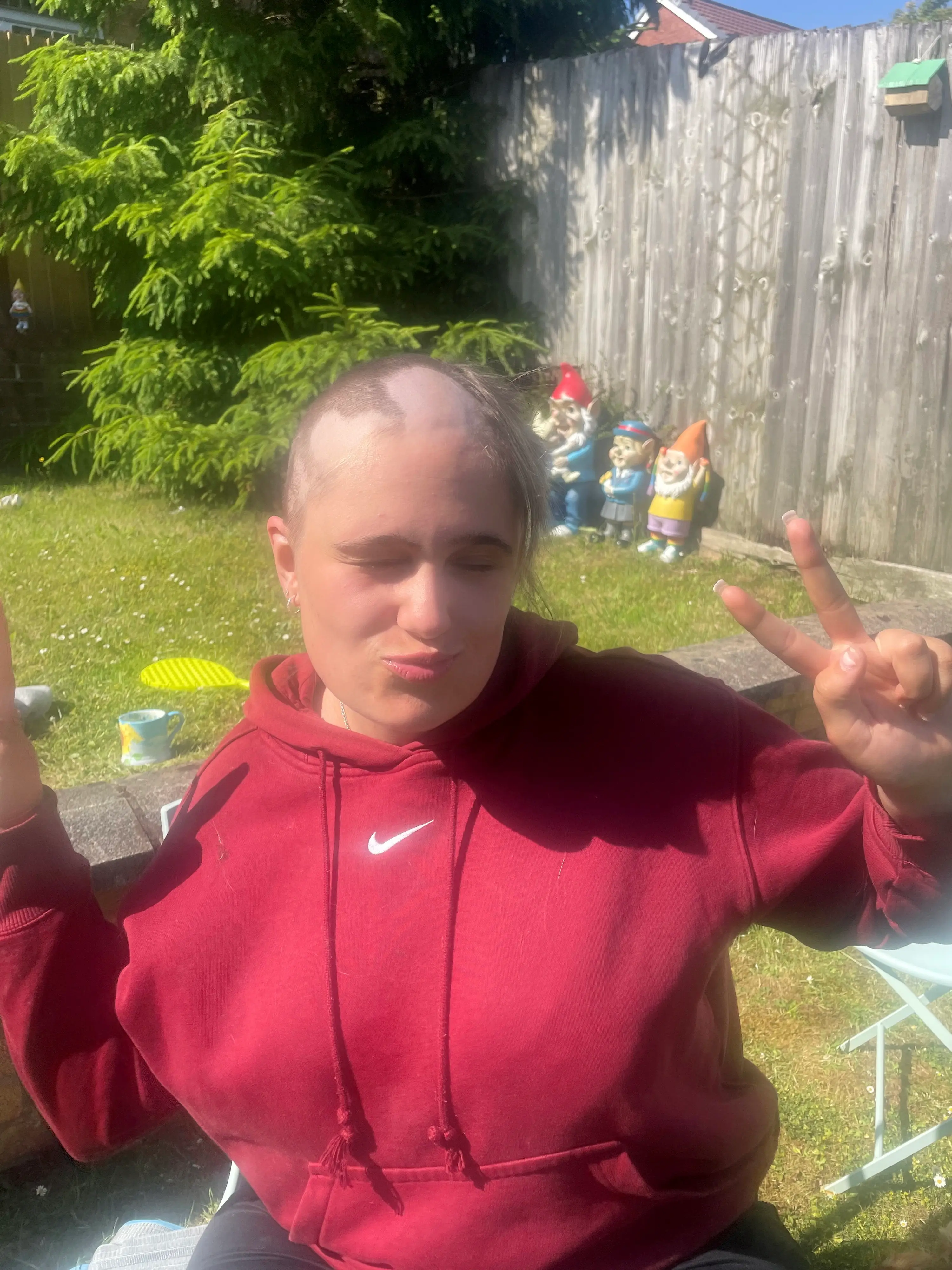 Phoebe also began losing hair, causing her to shave her head (SWNS)