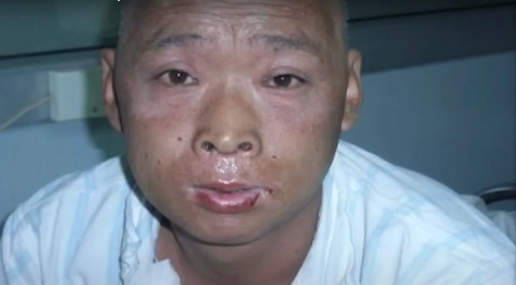 He had a low chance of survival and even begged for doctors to stop keeping him alive (Peaked Interest/YouTube)