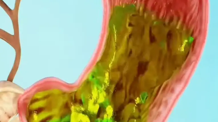 YouTube/Rapture Shorts