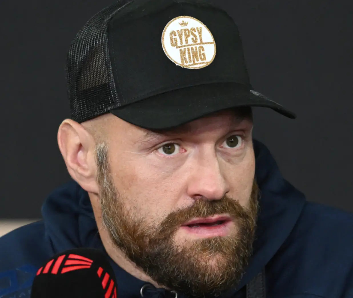 Tyson Fury's voice changed after he was punched in the throat.