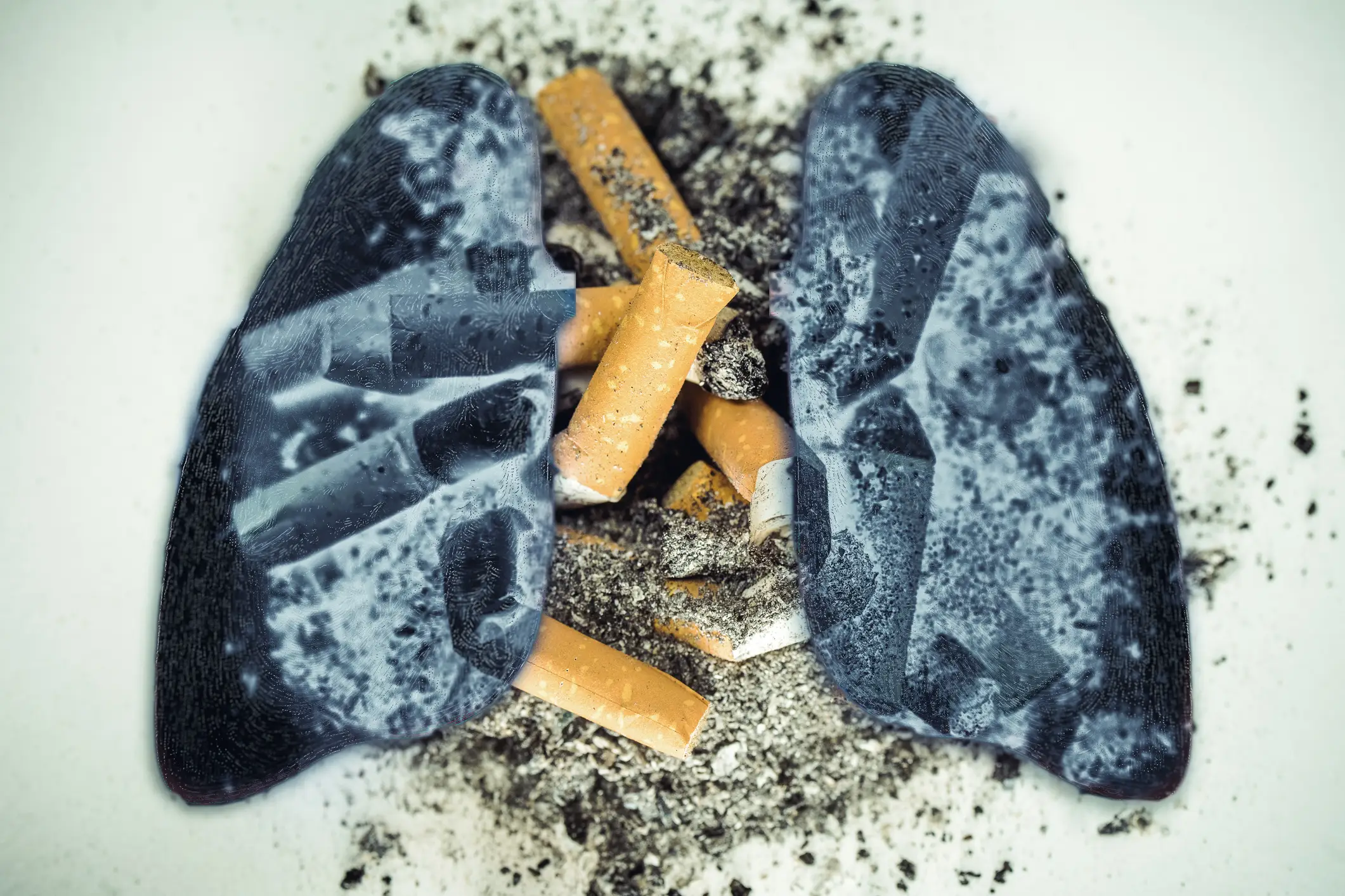 Lungs can't be pink again (Getty Stock)
