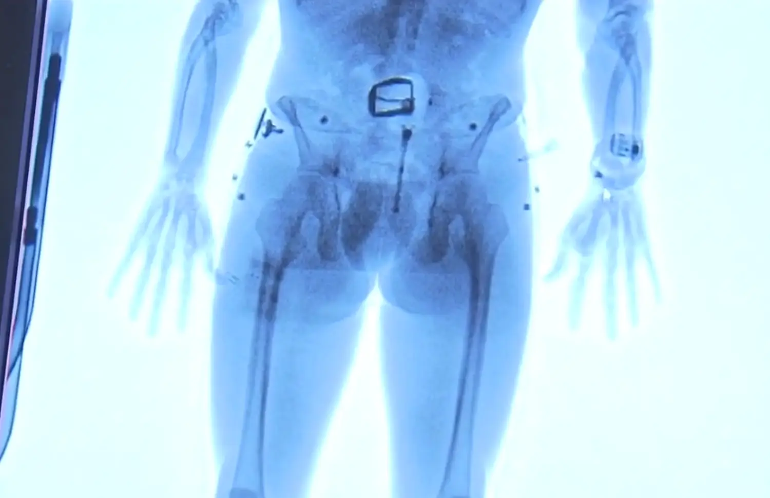 They can see a lot (KOIN 6)