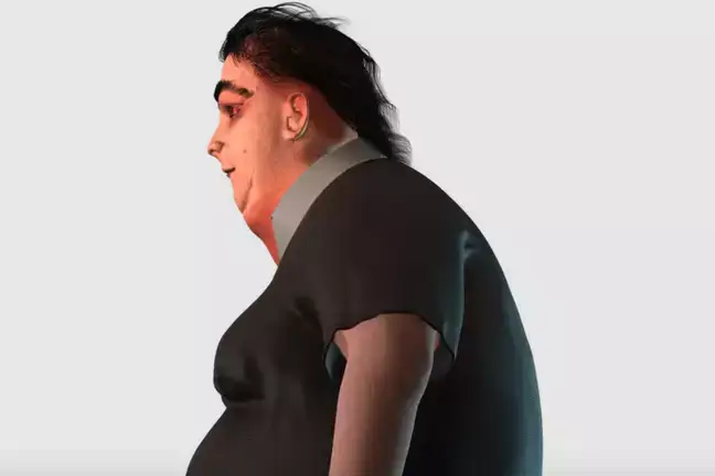 Susan has a range of health issues.