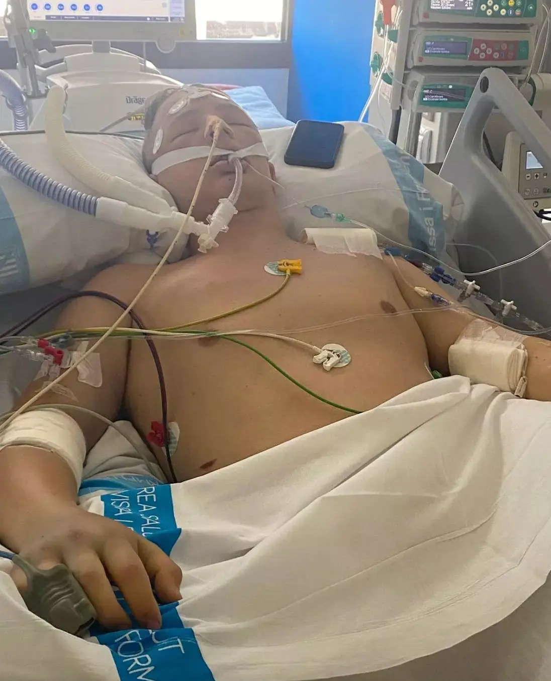 Ryan Long was hospitalised for days after the incident (SWNS)