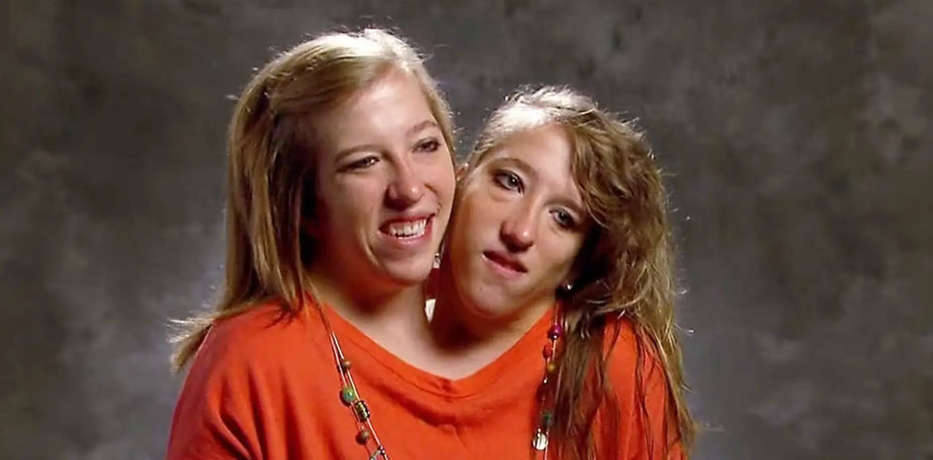 The twins have kept their day-to-day life incredibly private (TLC)