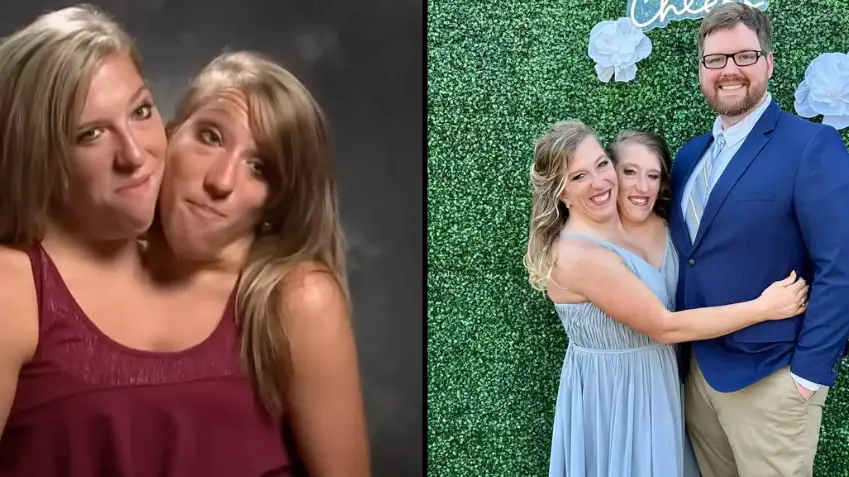 Old photo resurfaces after conjoined twin Abby Hensel leaves fans shocked with marriage revelation