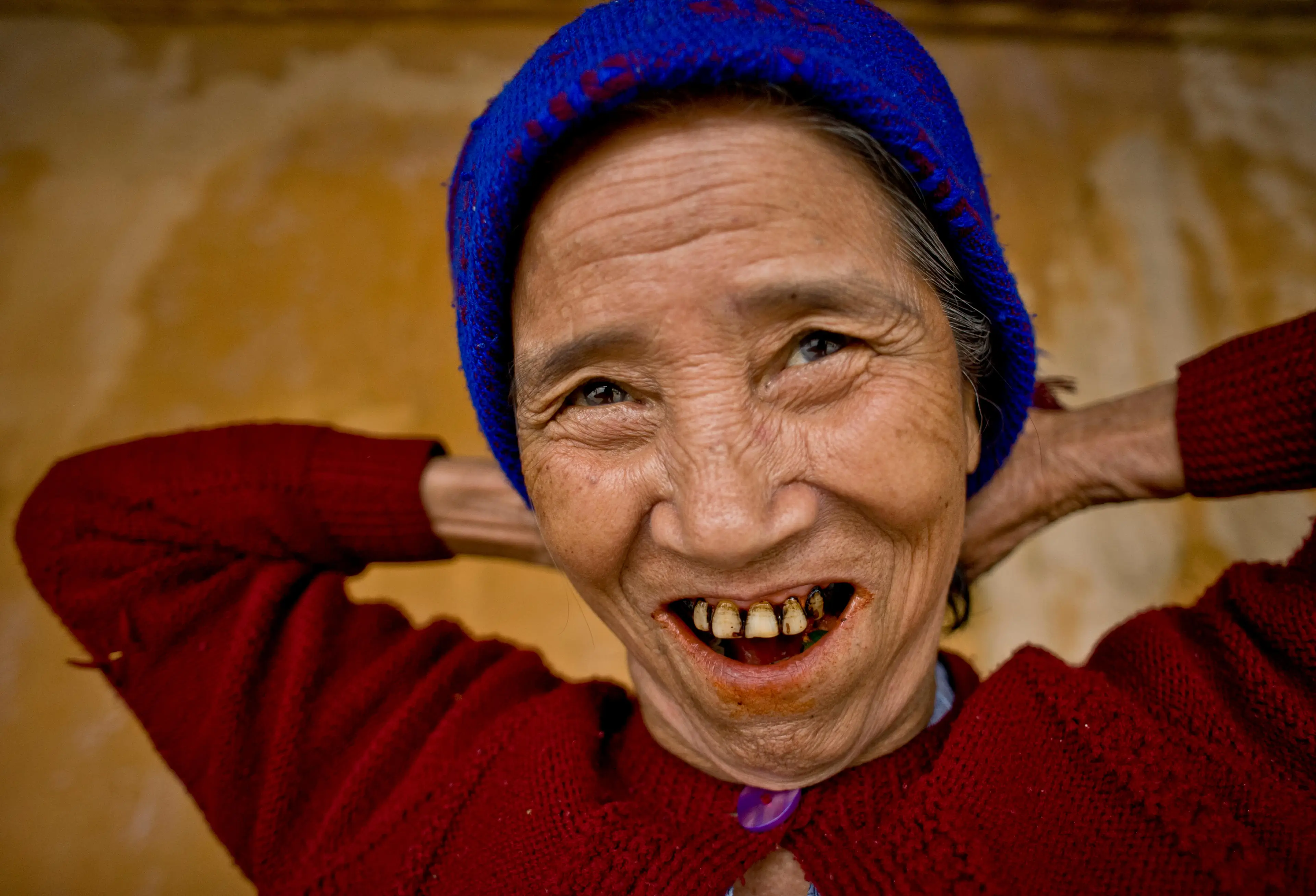 The betel nut can result in long-term oral health problems.