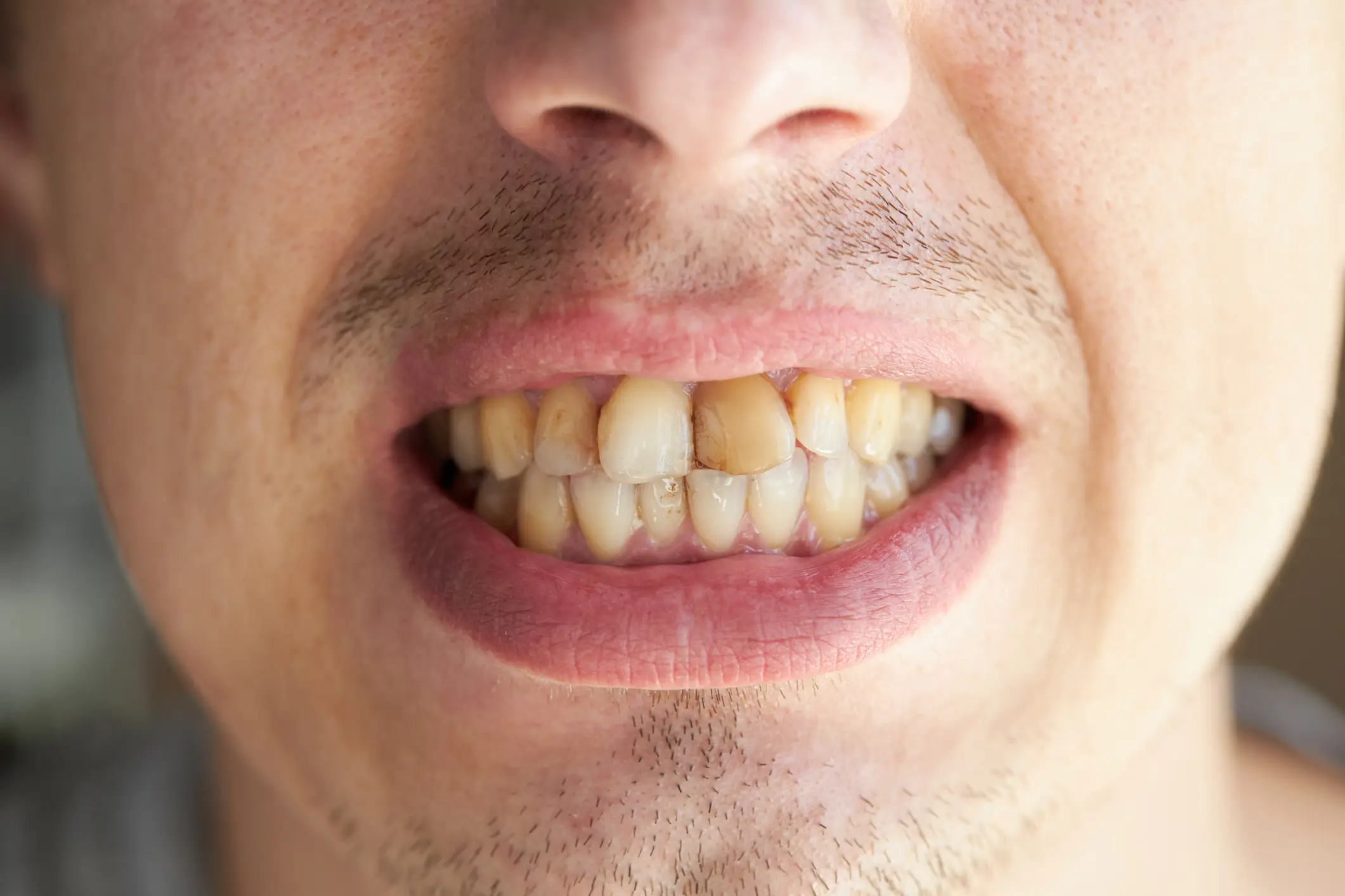 Have your teeth seen better days? (Getty Stock Images)