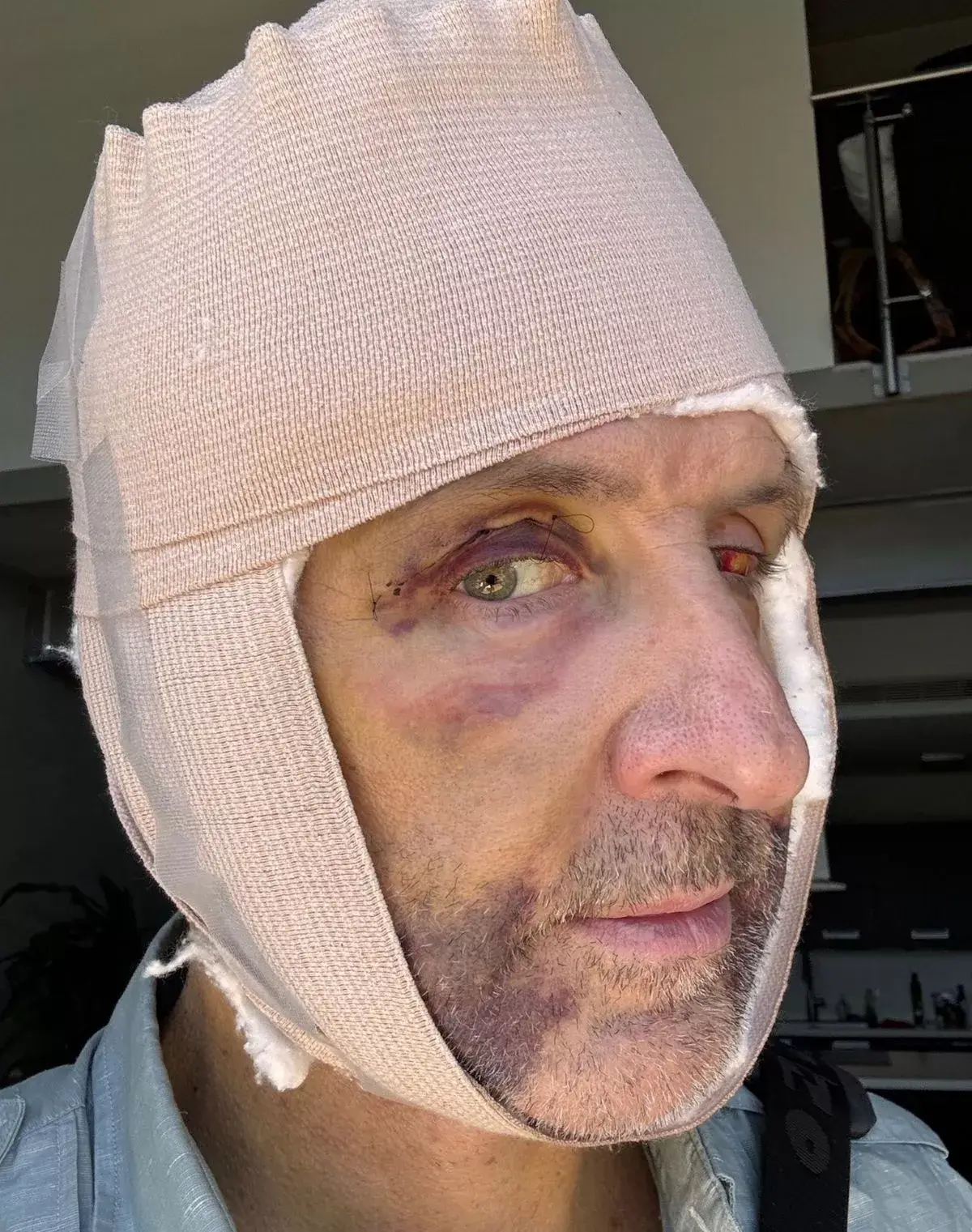 The businessman underwent the radical procedure in Costa Rica (Dave Asprey/Facebook)