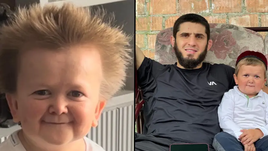 Why Hasbulla looks so much younger than he actually is