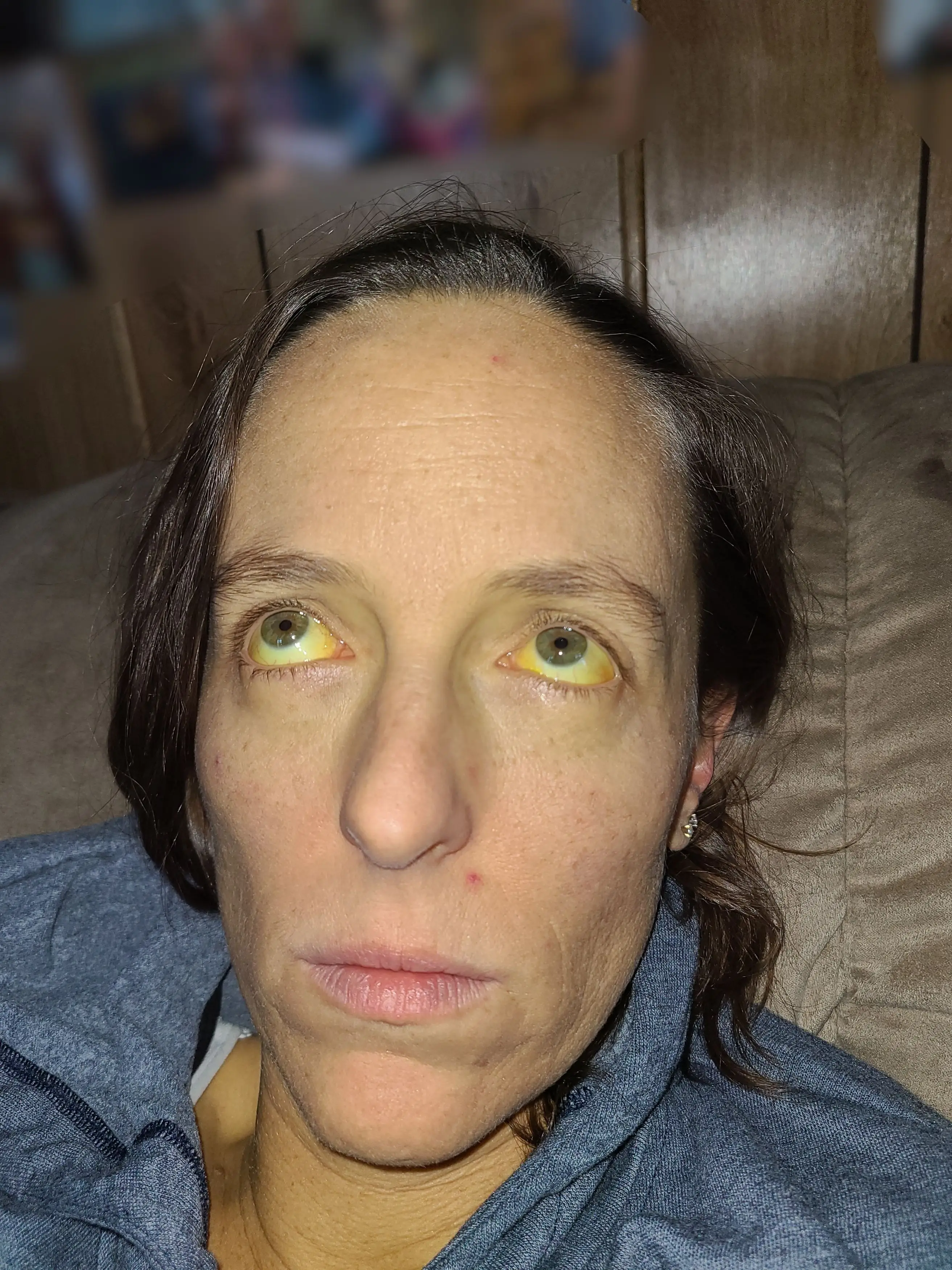 The 39-year-old was discharged after she stopped taking the supplements.