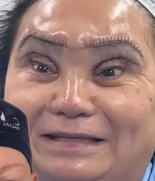 Dr Linkov was taken aback by the final result (YouTube/DrGaryLinkov)