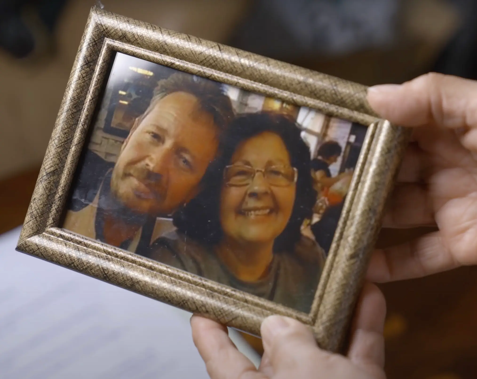 James was diagnosed with a vicious form of skin cancer, which took over his body (LADbible)