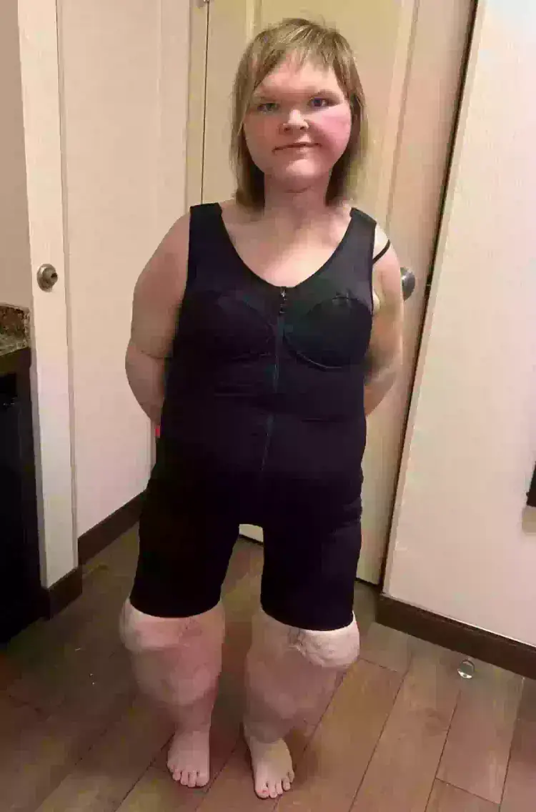 She's lost a lot of weight in the past few years and looks very different now (TikTok/TammySlaton) 