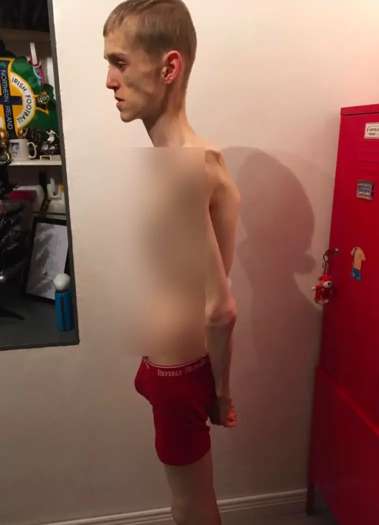 Jordan's weight significantly dropped (Jordan Caldwell)