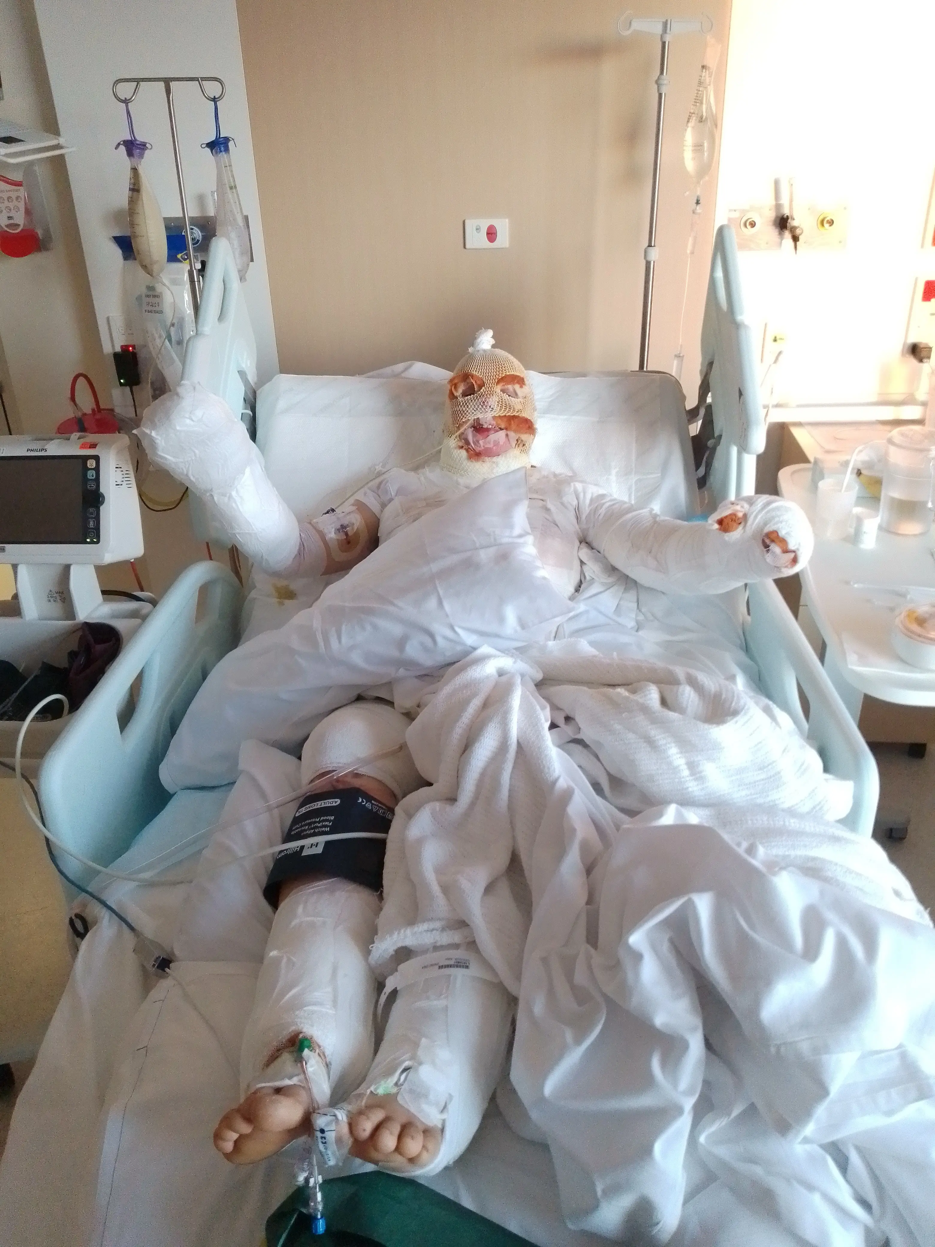 Katja Grosse was hospitalised when her homemade sauna exploded (GoFundMe)