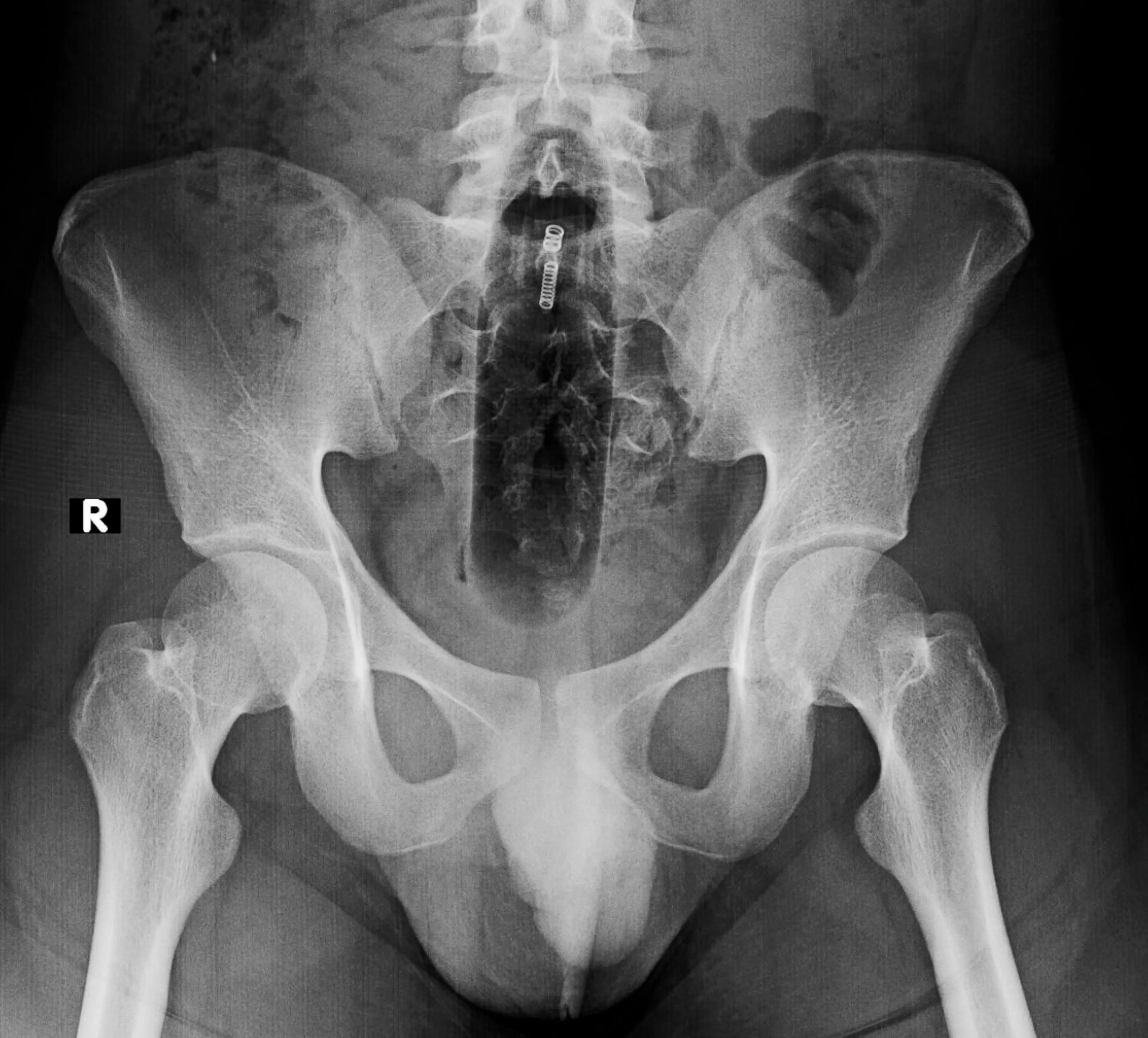 Over thousands of people are said to be hospitalised due to it each year. (Getty Stock Image)