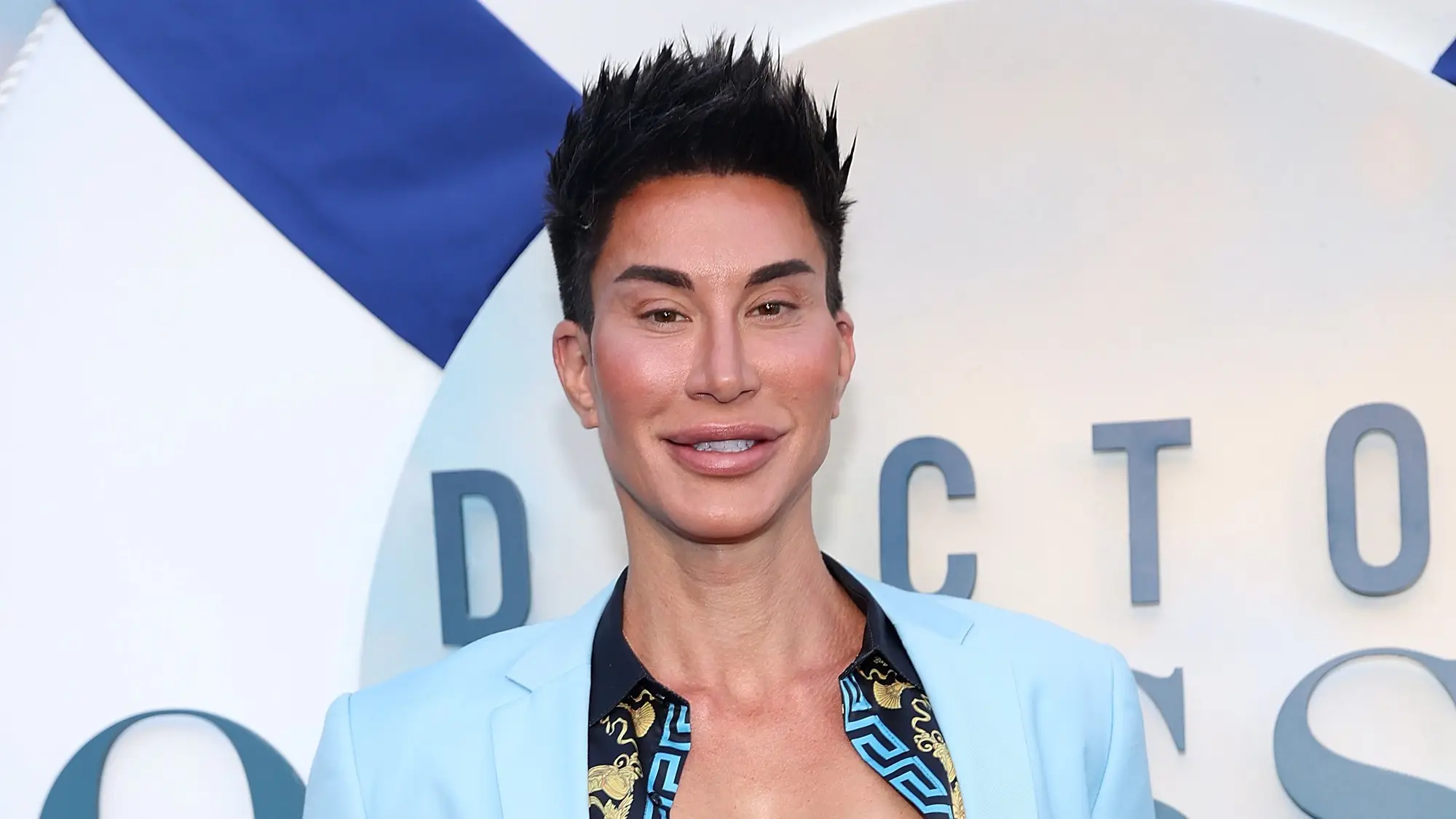 Human Ken Doll from Botched looked completely different before his extreme transformation
