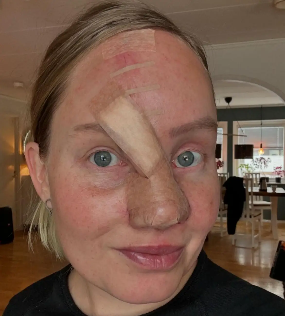 The Swedish influencer is now on the mend (Instagram/@charmlottan)